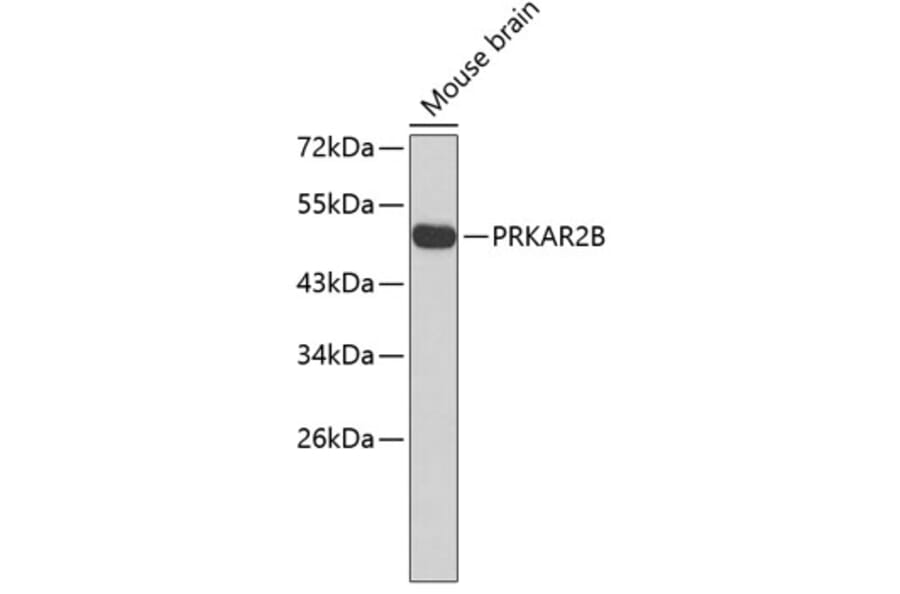 Western Blot - Anti-PRKAR2B Antibody (A3322) - Antibodies.com