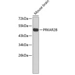 Western Blot - Anti-PRKAR2B Antibody (A3322) - Antibodies.com