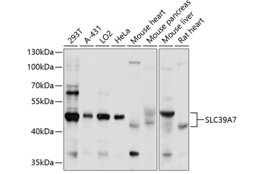 Western Blot - Anti-ZIP7 Antibody (A11635) - Antibodies.com