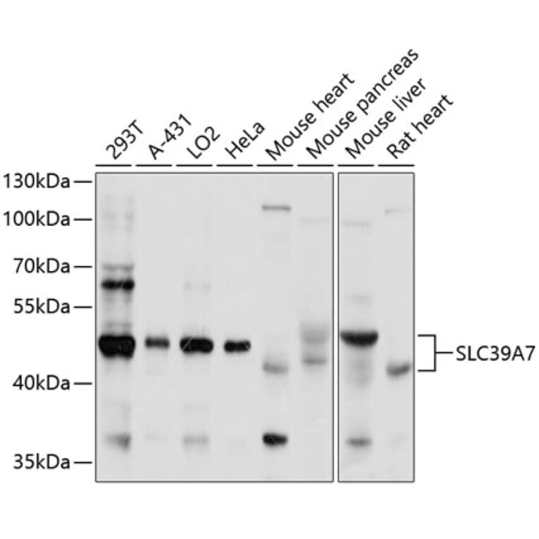 Western Blot - Anti-ZIP7 Antibody (A11635) - Antibodies.com