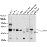 Western Blot - Anti-ZIP7 Antibody (A11635) - Antibodies.com