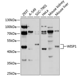 Western Blot - Anti-WISP1 Antibody (A11637) - Antibodies.com