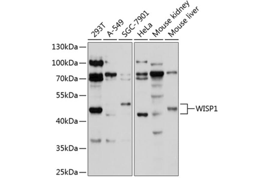 Western Blot - Anti-WISP1 Antibody (A11637) - Antibodies.com