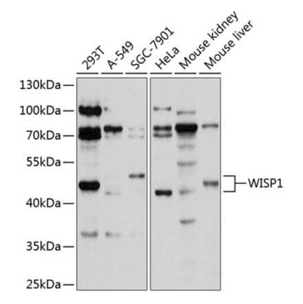 Western Blot - Anti-WISP1 Antibody (A11637) - Antibodies.com