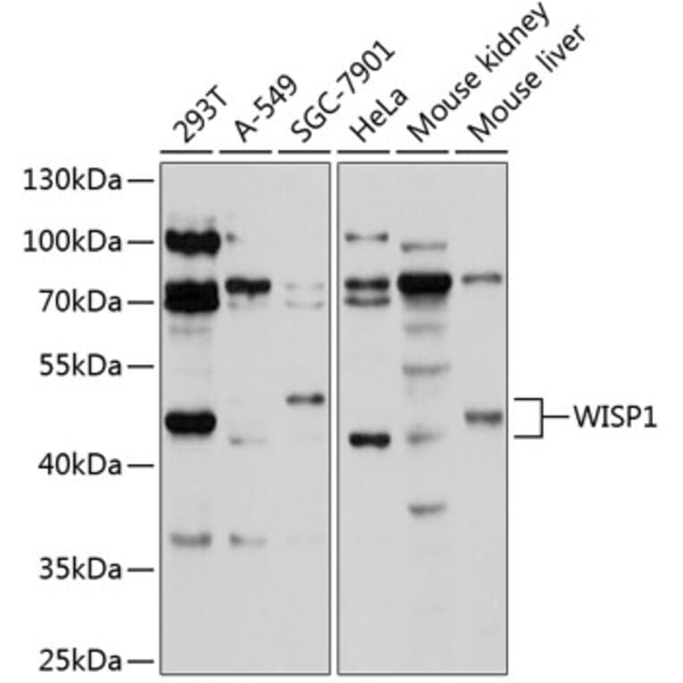 Western Blot - Anti-WISP1 Antibody (A11637) - Antibodies.com