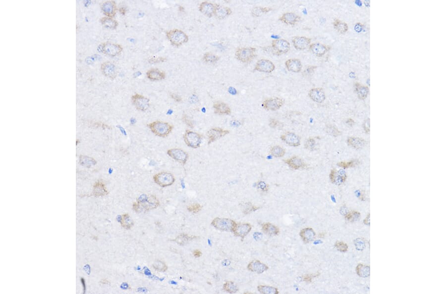 Immunohistochemistry - Anti-Ube4a Antibody (A11638) - Antibodies.com