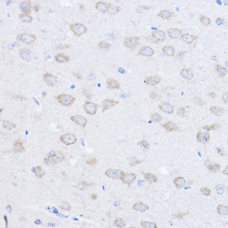 Immunohistochemistry - Anti-Ube4a Antibody (A11638) - Antibodies.com