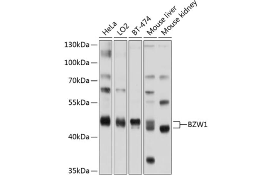 Western Blot - Anti-BZW1/Protein Orf Antibody (A11639) - Antibodies.com