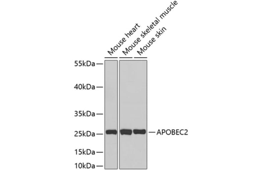Western Blot - Anti-APOBEC2 Antibody (A3375) - Antibodies.com