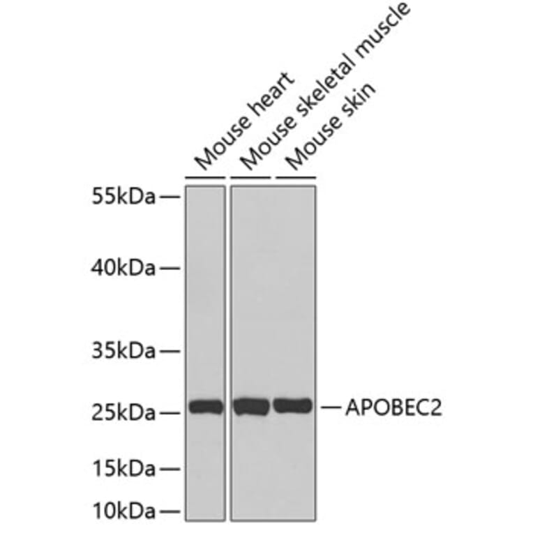 Western Blot - Anti-APOBEC2 Antibody (A3375) - Antibodies.com