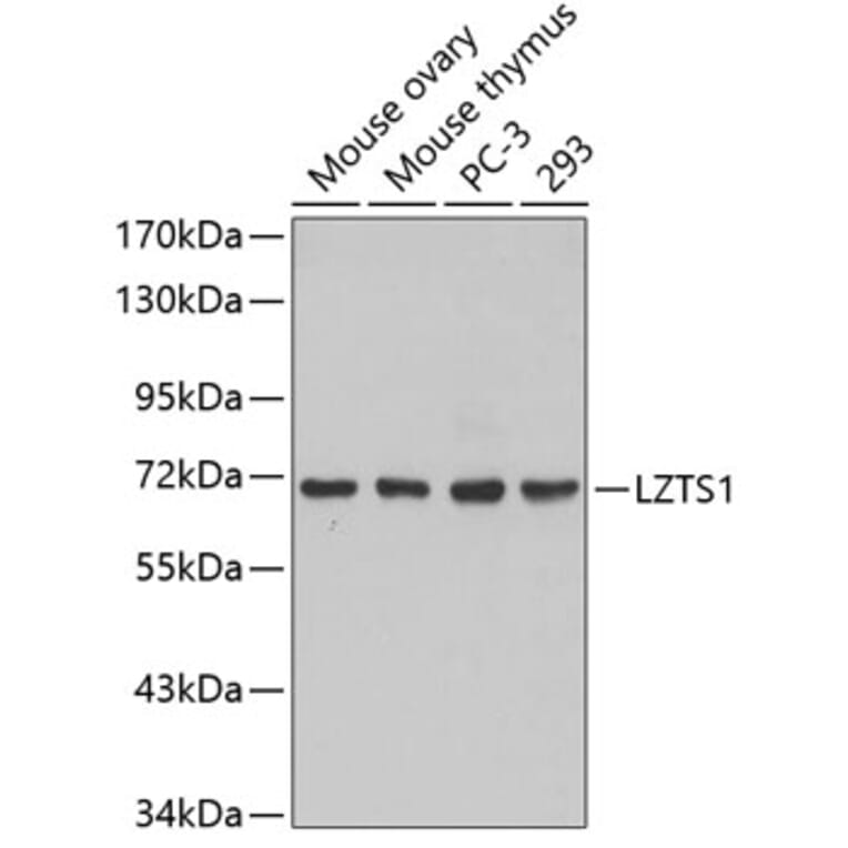 Western Blot - Anti-LZTS1 Antibody (A3380) - Antibodies.com