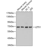 Western Blot - Anti-LZTS1 Antibody (A3380) - Antibodies.com