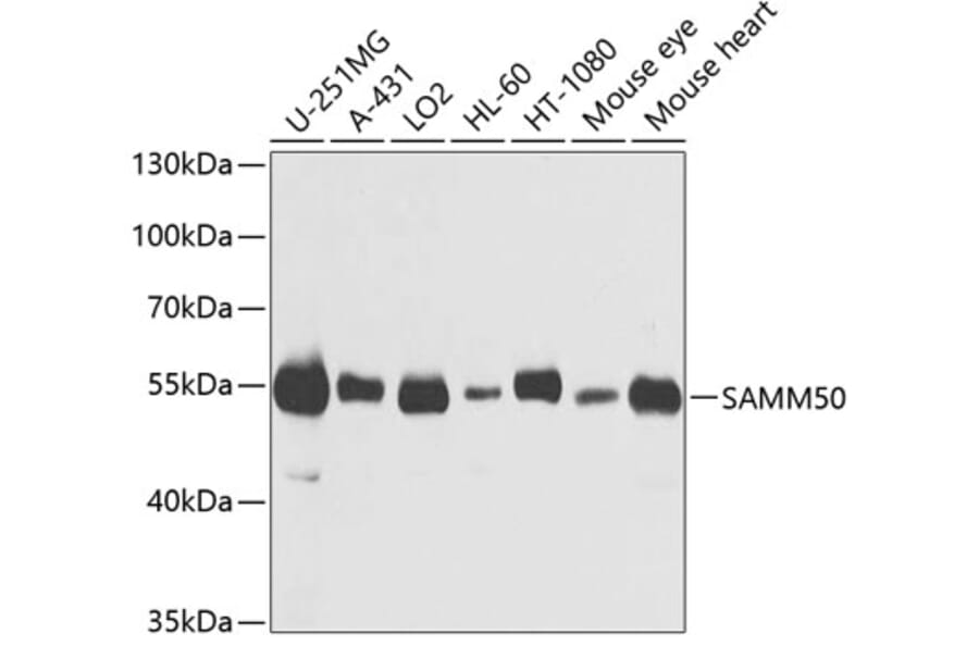Western Blot - Anti-SAMM50/SAM50 Antibody (A11642) - Antibodies.com