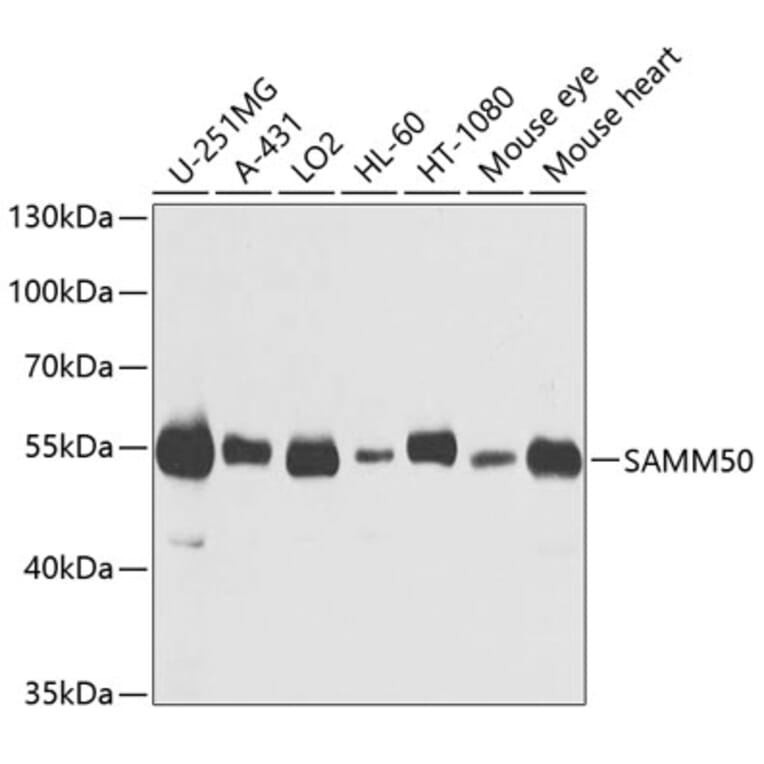 Western Blot - Anti-SAMM50/SAM50 Antibody (A11642) - Antibodies.com
