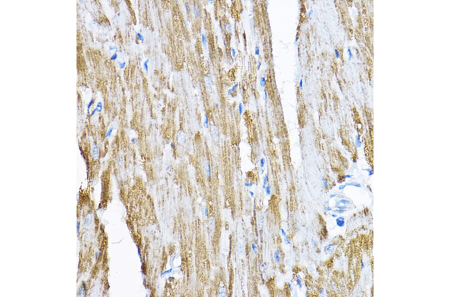 Immunohistochemistry - Anti-SAMM50/SAM50 Antibody (A11642) - Antibodies.com