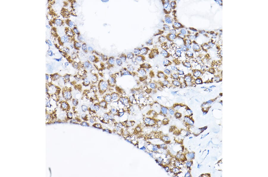 Immunohistochemistry - Anti-SAMM50/SAM50 Antibody (A11642) - Antibodies.com