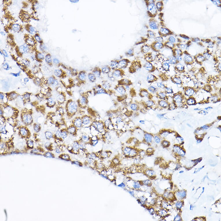 Immunohistochemistry - Anti-SAMM50/SAM50 Antibody (A11642) - Antibodies.com