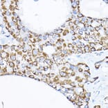 Immunohistochemistry - Anti-SAMM50/SAM50 Antibody (A11642) - Antibodies.com