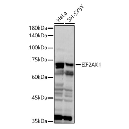 Western Blot - Anti-Heme-regulated inhibitor Antibody (A11643) - Antibodies.com