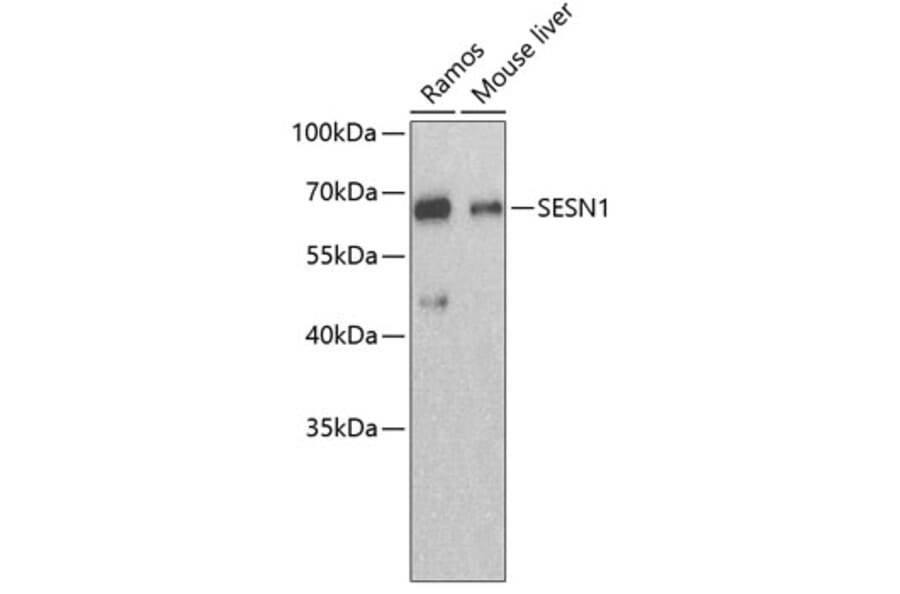 Western Blot - Anti-SESN1 Antibody (A3417) - Antibodies.com
