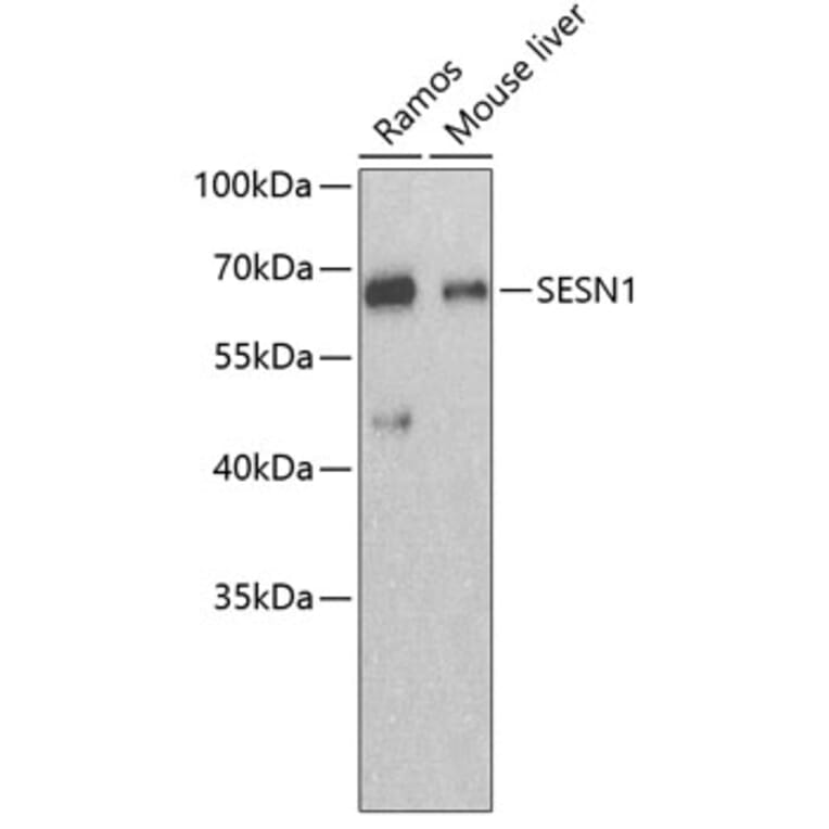 Western Blot - Anti-SESN1 Antibody (A3417) - Antibodies.com