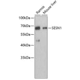 Western Blot - Anti-SESN1 Antibody (A3417) - Antibodies.com