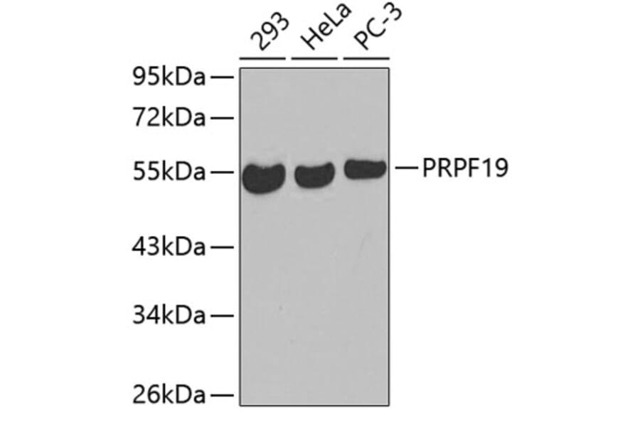 Western Blot - Anti-PRPF19 Antibody (A3419) - Antibodies.com