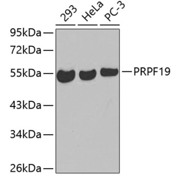 Western Blot - Anti-PRPF19 Antibody (A3419) - Antibodies.com