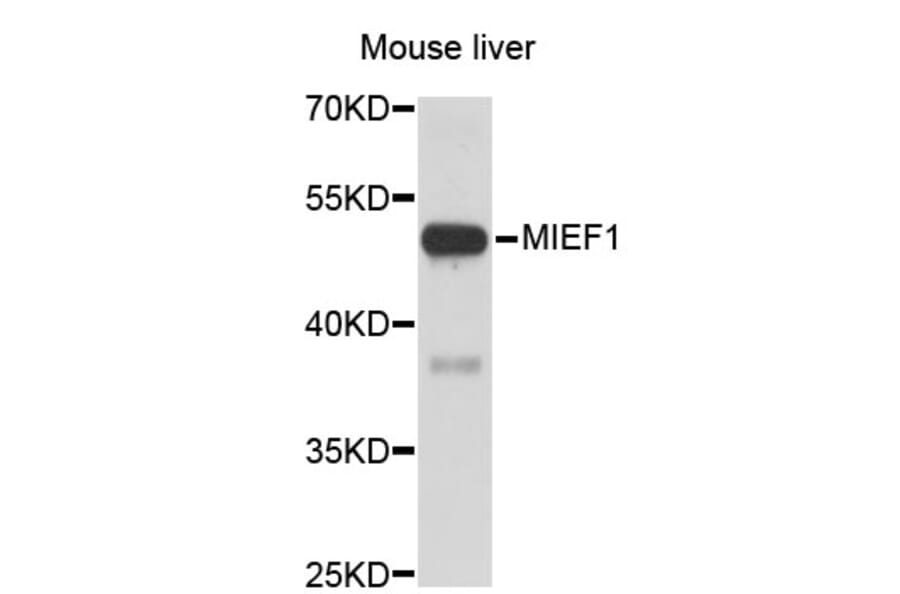 Western Blot - Anti-MIEF1 Antibody (A3440) - Antibodies.com