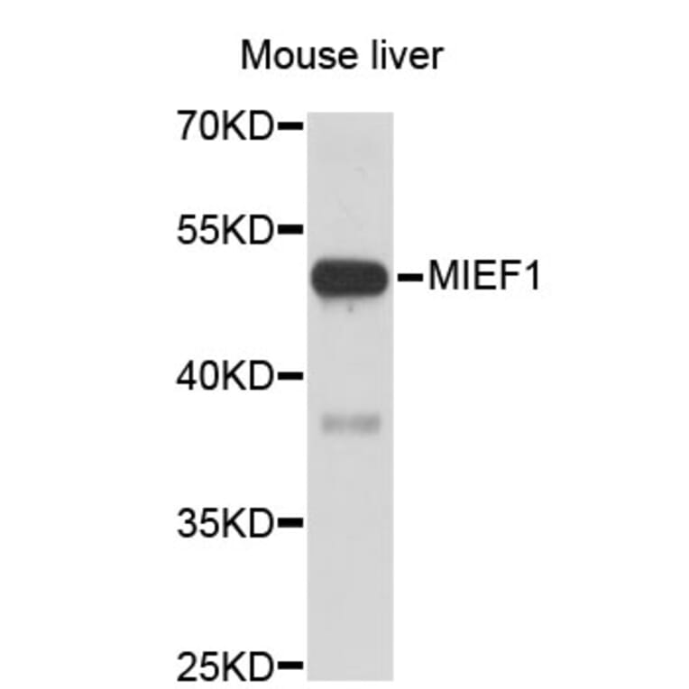 Western Blot - Anti-MIEF1 Antibody (A3440) - Antibodies.com