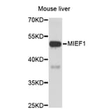 Western Blot - Anti-MIEF1 Antibody (A3440) - Antibodies.com