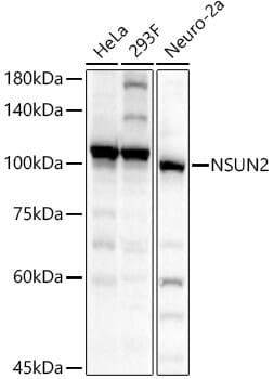 Western blot analysis of extracts of various cell lines, using Anti-NSUN2 Antibody (A3443) at 1:1,000 dilution.
Secondary antibody: Goat Anti-Rabbit IgG (H+L) (HRP) (AS014) at 1:10,000 dilution.
Lysates / proteins: 25µg per lane.
Blocking buffer: 3% non-fat dry milk in TBST.
Detection: ECL Basic Kit (RM00020).
Exposure time: 10s.