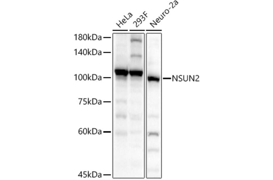 Western Blot - Anti-NSUN2/SAKI Antibody (A11647) - Antibodies.com