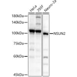 Western Blot - Anti-NSUN2/SAKI Antibody (A11647) - Antibodies.com