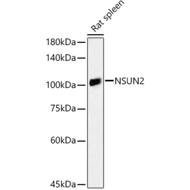 Western Blot - Anti-NSUN2/SAKI Antibody (A11647) - Antibodies.com