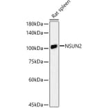 Western Blot - Anti-NSUN2/SAKI Antibody (A11647) - Antibodies.com