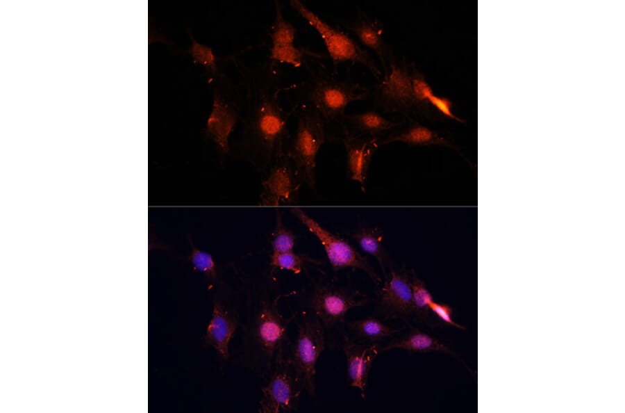 Immunofluorescence - Anti-NSUN2/SAKI Antibody (A11647) - Antibodies.com