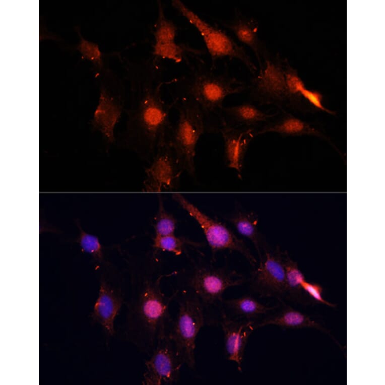 Immunofluorescence - Anti-NSUN2/SAKI Antibody (A11647) - Antibodies.com