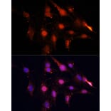 Immunofluorescence - Anti-NSUN2/SAKI Antibody (A11647) - Antibodies.com