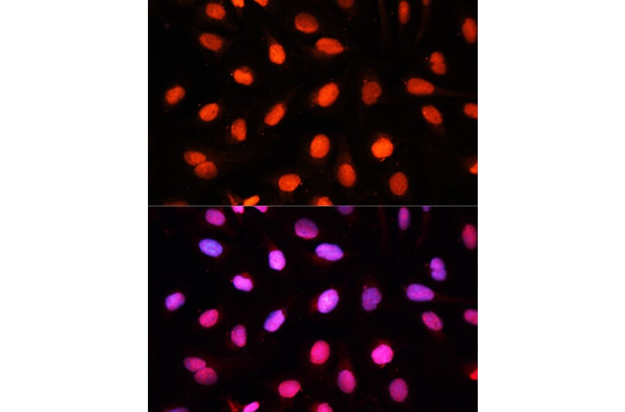 Immunofluorescence - Anti-NSUN2/SAKI Antibody (A11647) - Antibodies.com