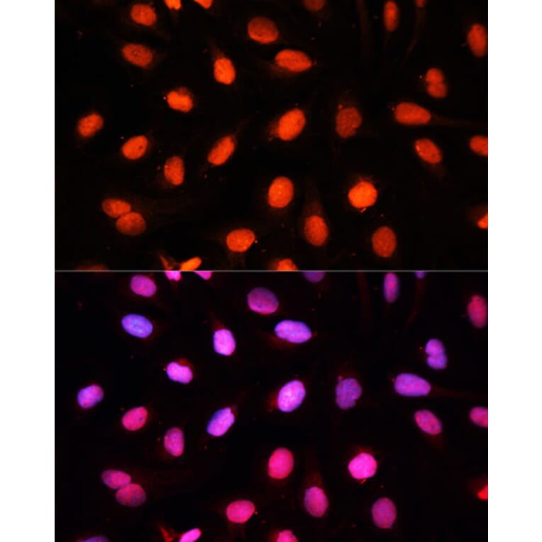 Immunofluorescence - Anti-NSUN2/SAKI Antibody (A11647) - Antibodies.com
