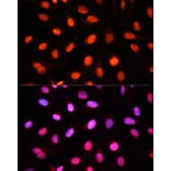 Immunofluorescence - Anti-NSUN2/SAKI Antibody (A11647) - Antibodies.com