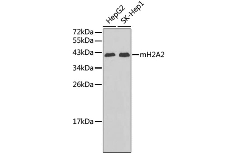 Western Blot - Anti-mH2A2 Antibody (A3453) - Antibodies.com