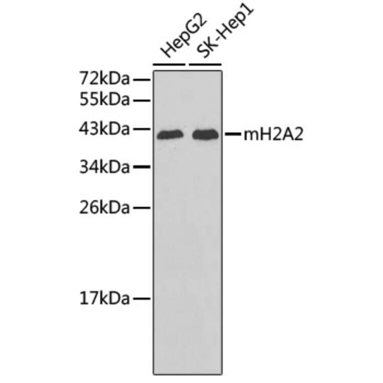 Western Blot - Anti-mH2A2 Antibody (A3453) - Antibodies.com