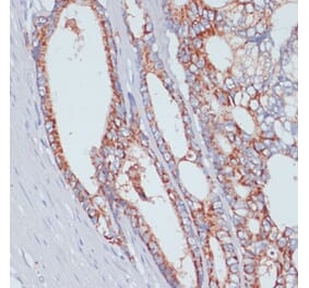 Immunohistochemistry - Anti-ZIP-4 Antibody (A11649) - Antibodies.com