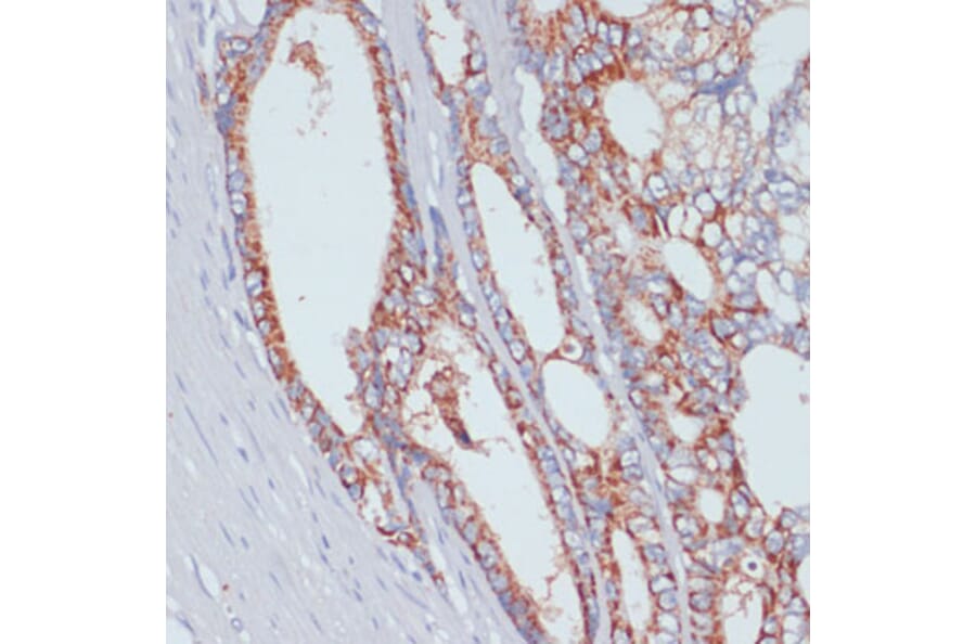 Immunohistochemistry - Anti-ZIP-4 Antibody (A11649) - Antibodies.com