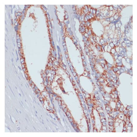 Immunohistochemistry - Anti-ZIP-4 Antibody (A11649) - Antibodies.com