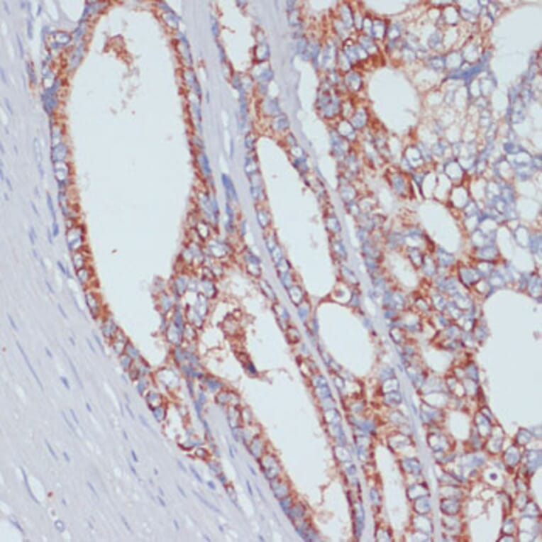 Immunohistochemistry - Anti-ZIP-4 Antibody (A11649) - Antibodies.com