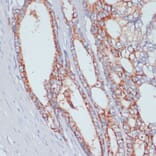 Immunohistochemistry - Anti-ZIP-4 Antibody (A11649) - Antibodies.com