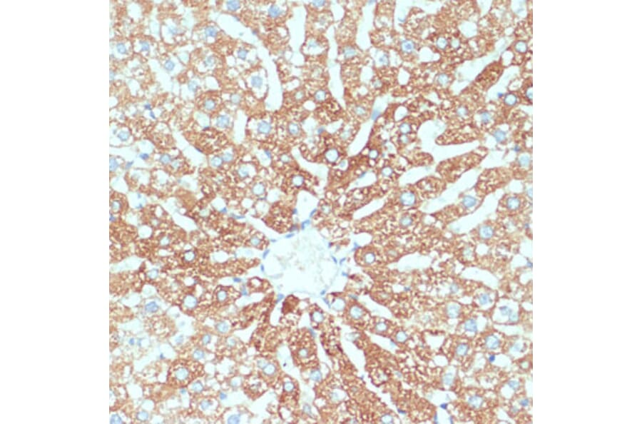 Immunohistochemistry - Anti-ZIP-4 Antibody (A11649) - Antibodies.com